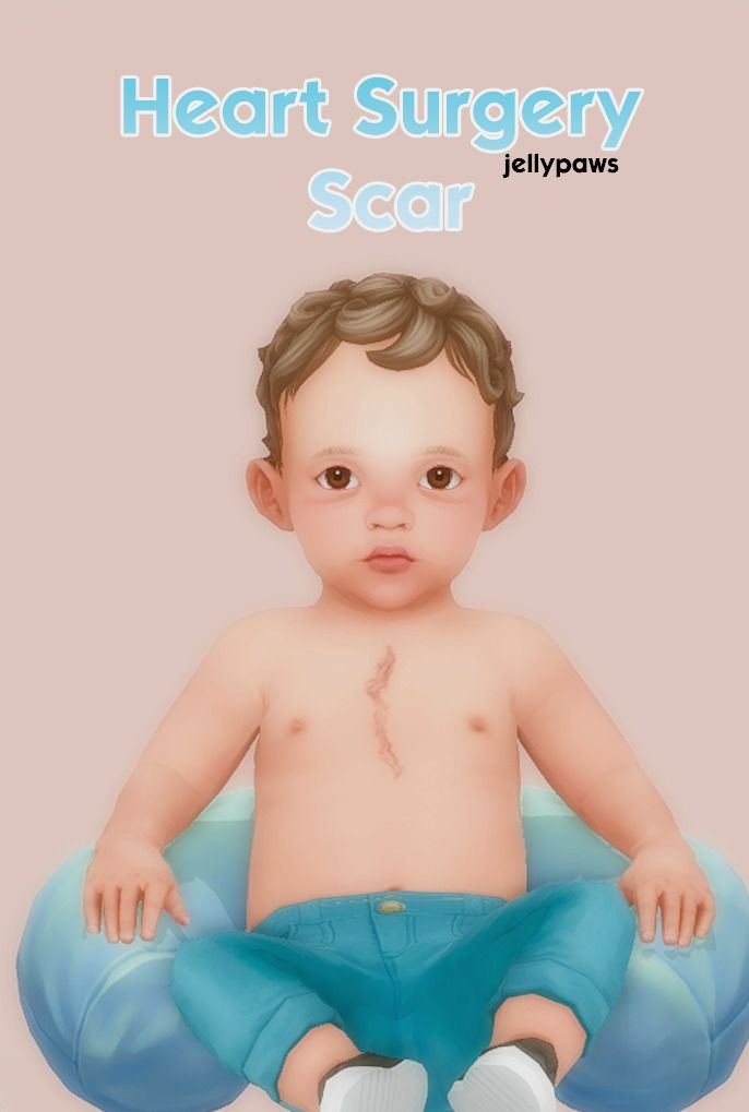 sims 4 maxis match scars