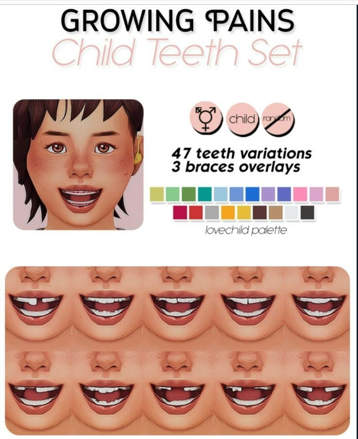 25+ Sims 4 Teeth CC and Mods (Replacement, Overlay, and More)