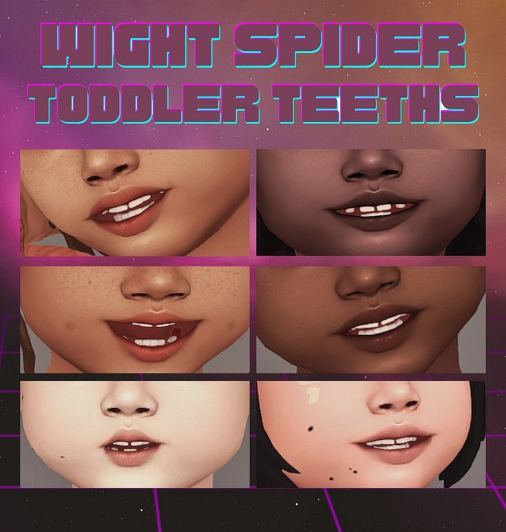 toddler teeth cc sims 4