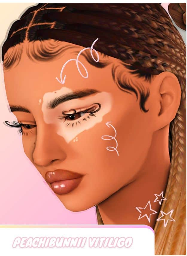 sims 4 vitiligo face details